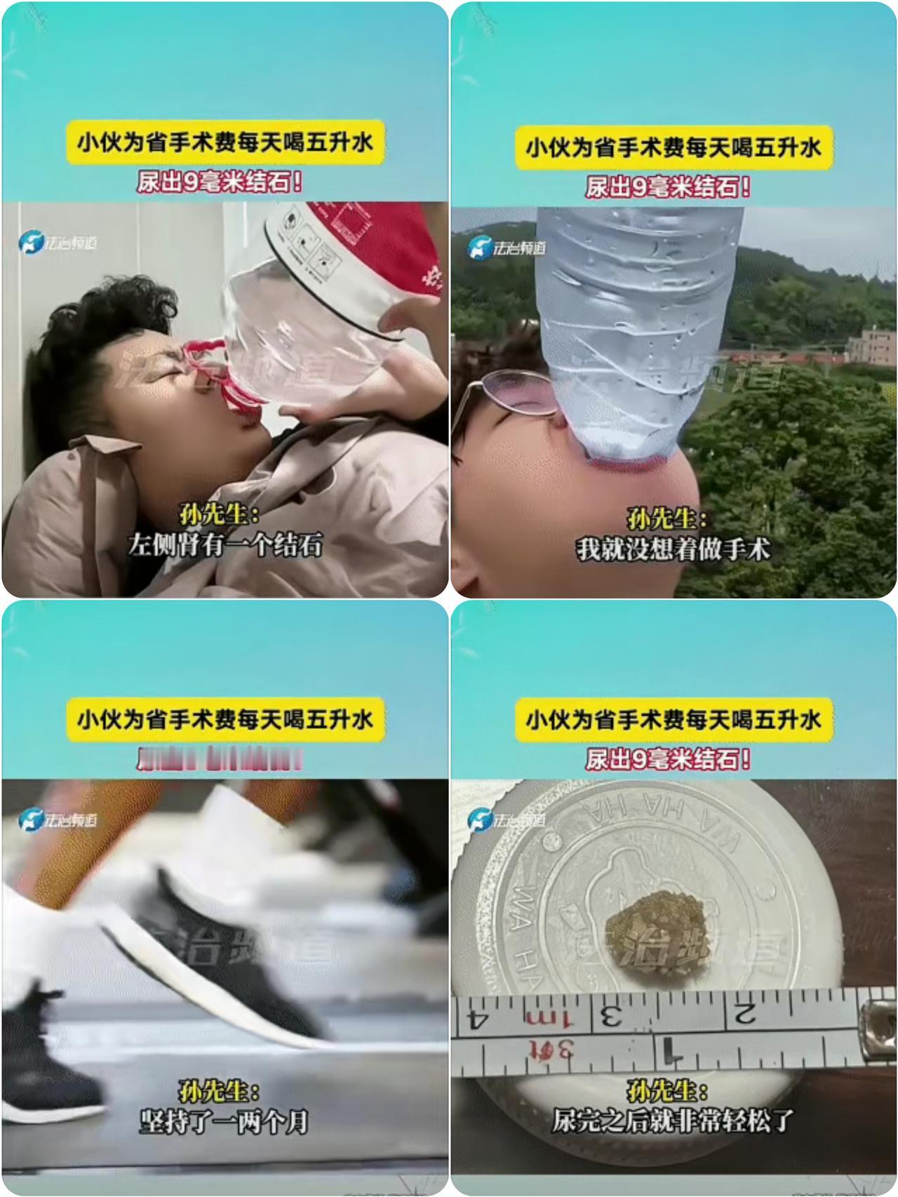 孙先生的狠劲真让人佩服！查出肾结石，听到手术费一万多，他直接放弃手术，每天硬灌