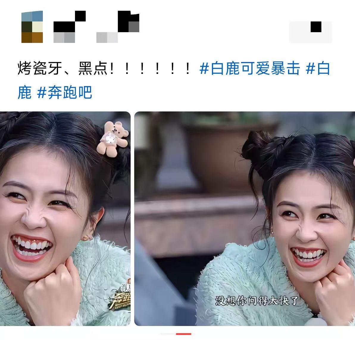 这么美的脸，毁在这一口牙上？