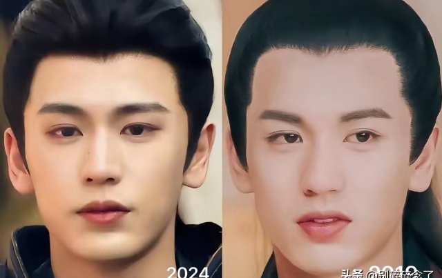 张凌赫前几部剧有点嘴凸还挺明显的！现在根本没有这种情况了！去看他素人时期就知道眉