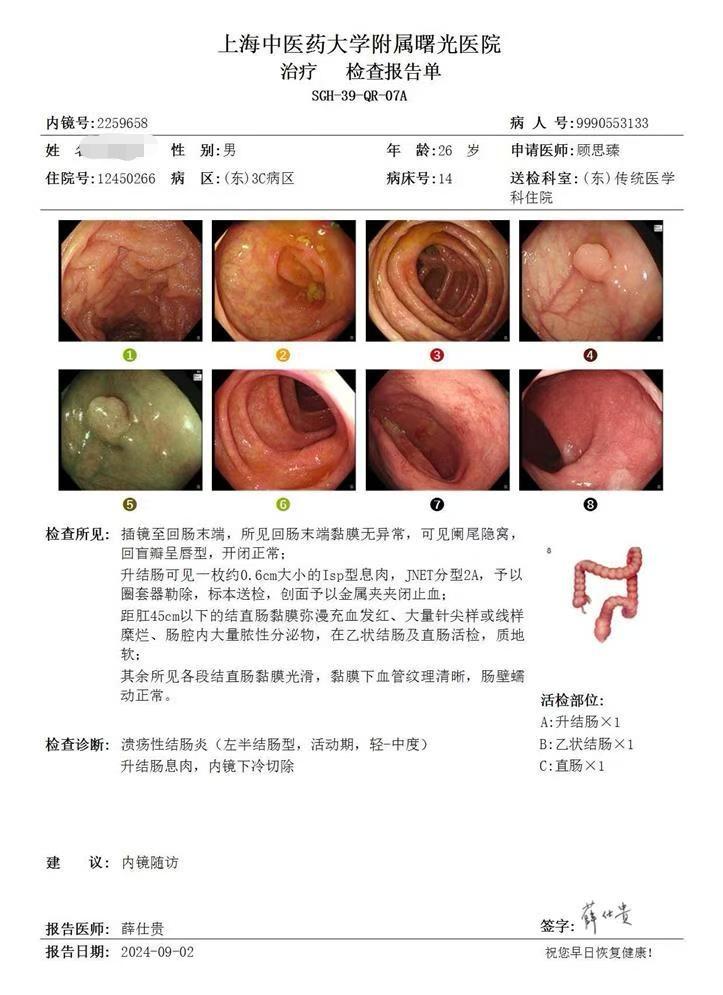 溃疡性结肠炎的治疗个体差异很大。 1.你是不是溃疡性结肠炎，还是结肠溃...