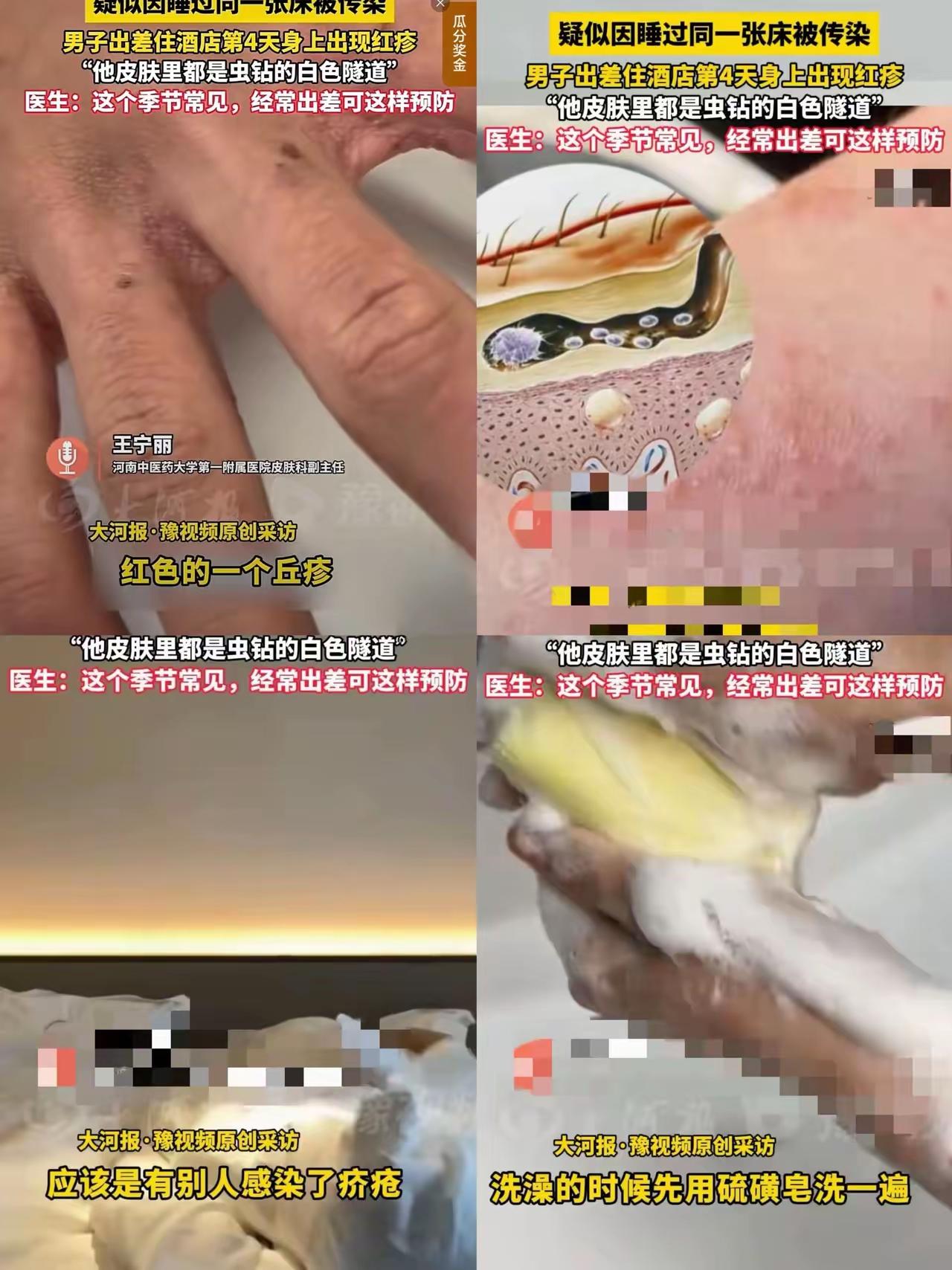 一觉醒来，经常出差住酒店的朋友们要小心了！近日，一男子因为出差，住了一家酒店。结