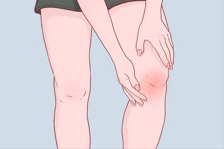 肺癌一查就是晚期?其实腿部早就给了暗示!出现3变化,尽早筛查肺癌被发现的时候