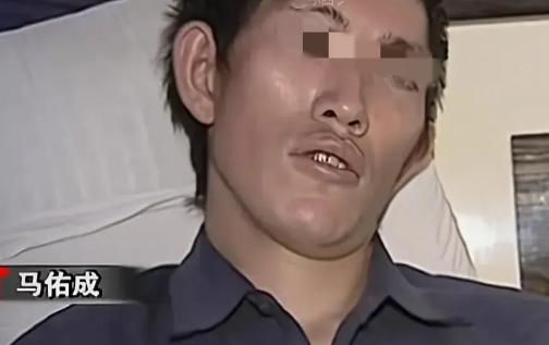 2006年，云南25岁农民突然晕倒在街头，医院竟查出他体内有钢针。谁曾想，手术取