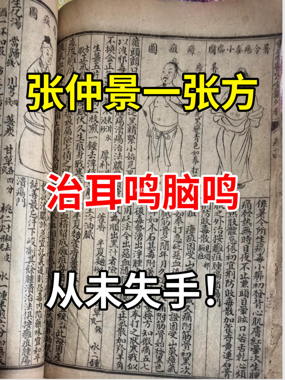 张仲景一张方，治脑鸣从未失手！ - 中医承载着数千年的智慧结晶，到现在...