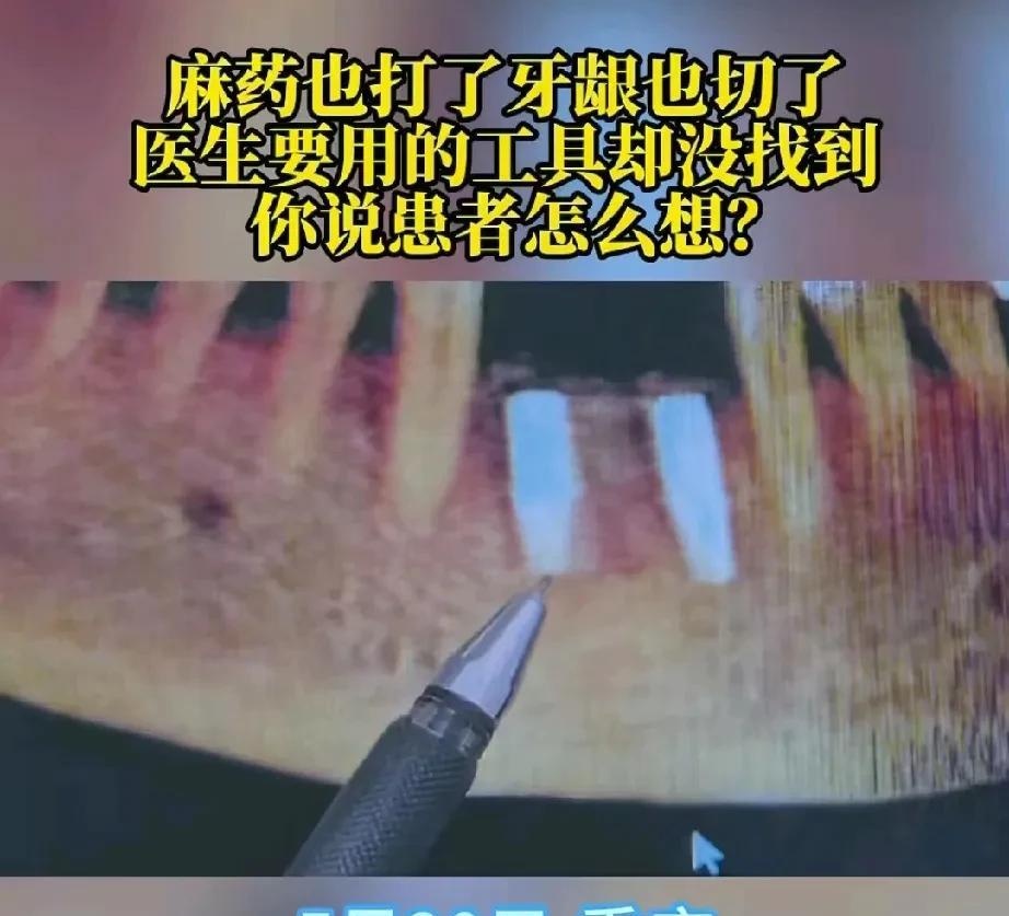 重庆，男子去医院种植牙，医生给他打完麻醉，用刀割开牙龈后，突然发现手术工具不齐，