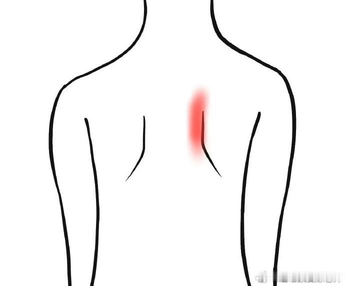 100个损伤康复说明书我们之前讲过很多次肩关节弹响，其实“肩胛骨”也有可能弹响