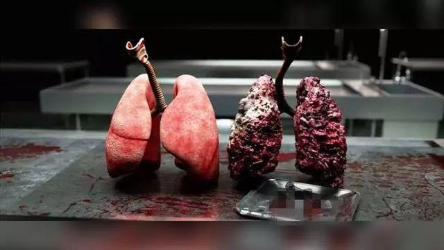 一天一包烟, 没有出现这四个症状, 说明你的肺部还算健康!