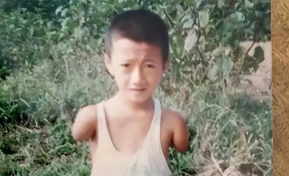 1986年辽宁锦州的土坯房里，一个天生无手无脚的男婴降生，罹患罕见的先天性海豹肢