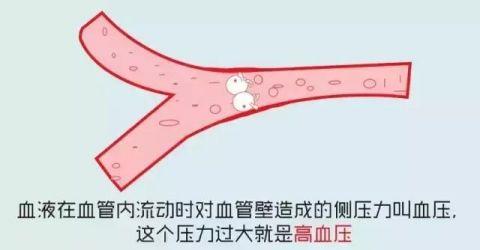 高血压知识大全, 你想知道的全在里面