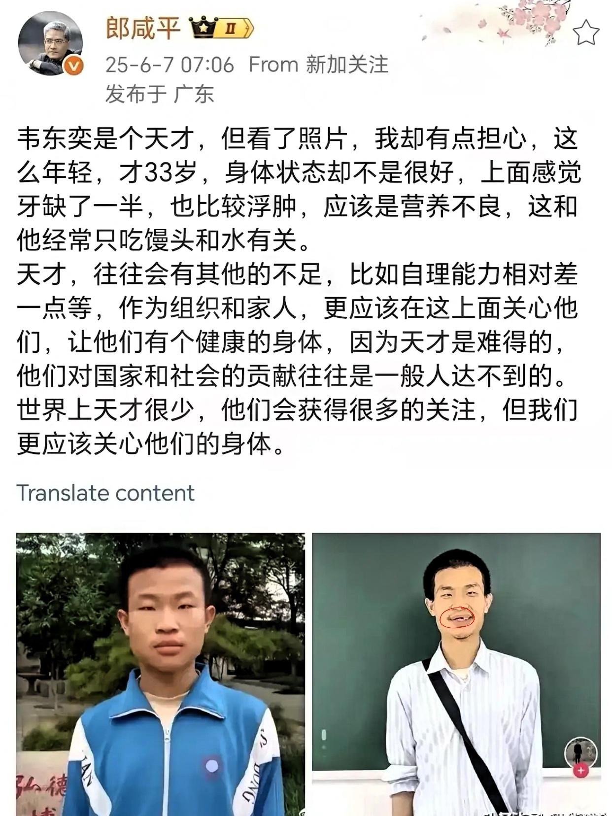 郎咸平称：韦东奕身体状况欠佳。​​他应该和陈景润一样，高功能阿斯伯格综合征，
