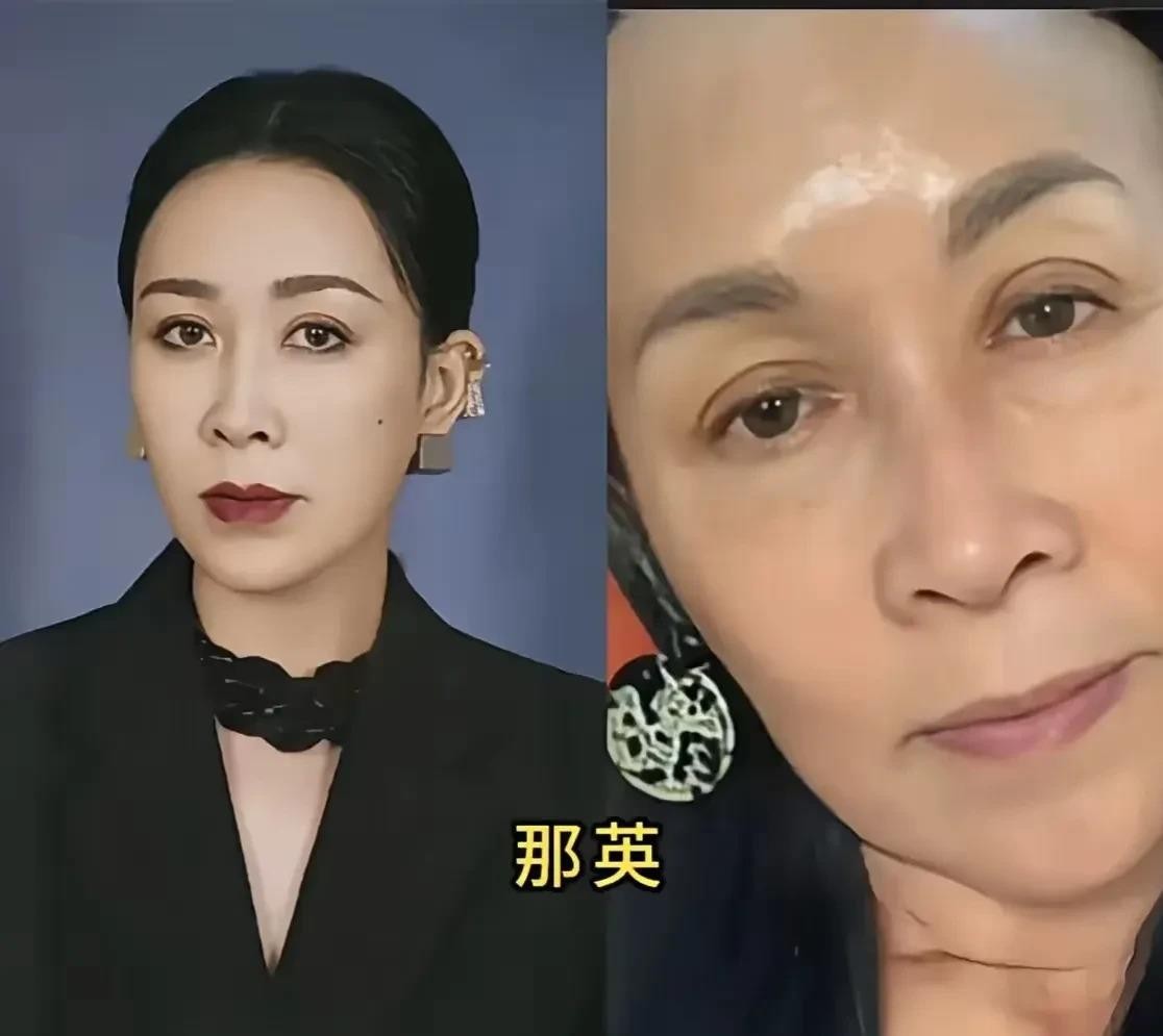 那英、谢娜、佟丽娅的素颜照，网上一直有讨论。那英卸了妆，五官还是大气的，皮肤状态也在，少了舞台上那股