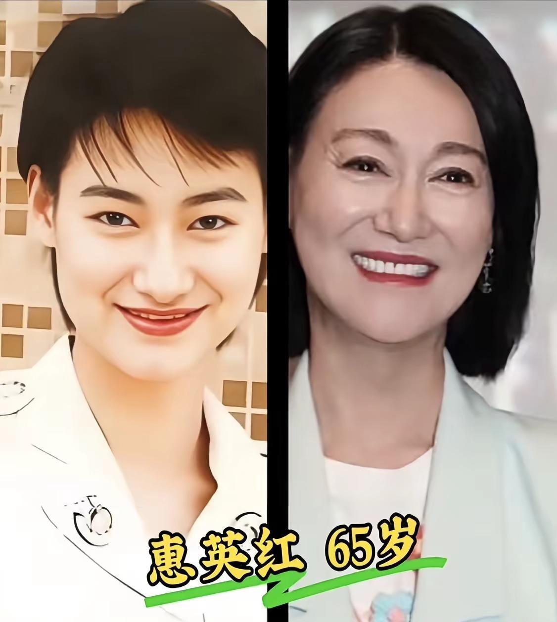 一张医美恢复期的“肿脸”，意外扯下了娱乐圈审美的遮羞布。过去那套“白幼瘦”的工