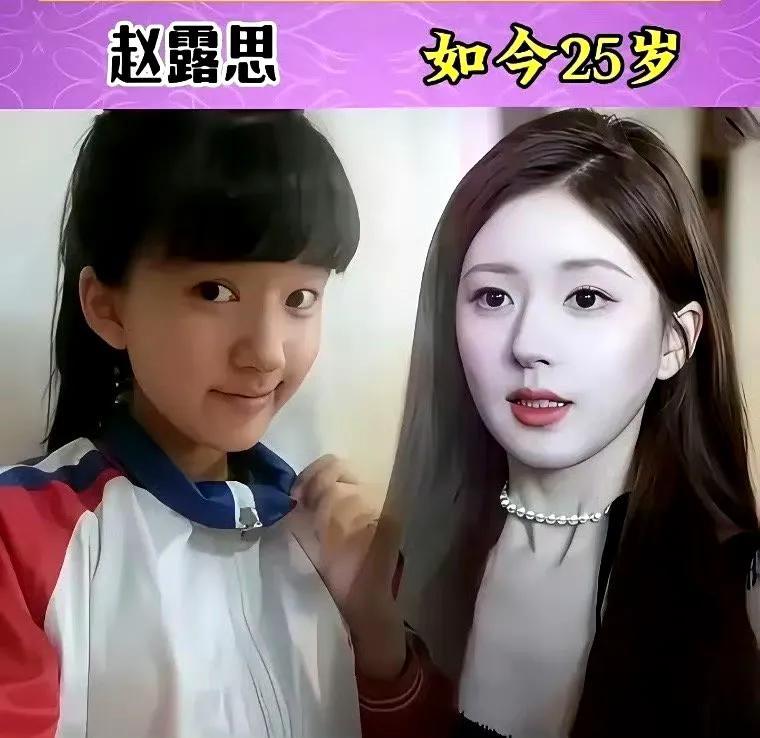 女星前后变化，鞠敬伟、杨紫像换了一个人。分享几张娱乐圈当红女星前后对比照片，