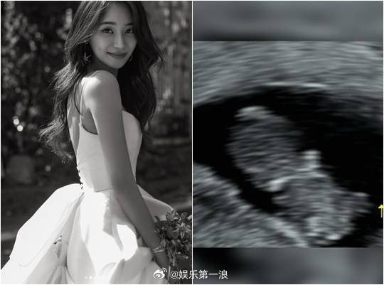 AOA徐酉奈怀孕AOA徐酉奈当妈AOA成员徐酉奈公布怀孕喜讯4日，酉奈通过个