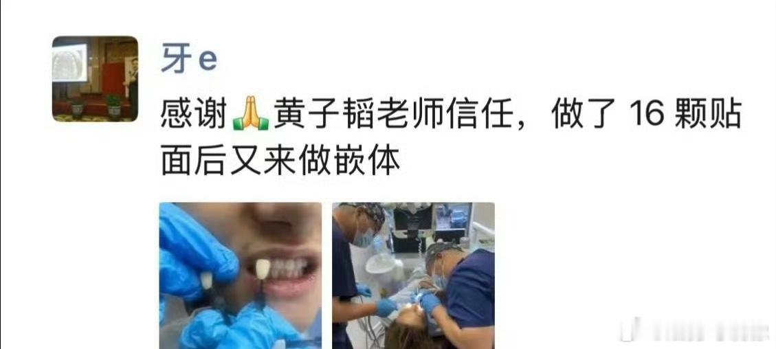 黄子韬怒斥偷拍牙医就算是明星也是顾客啊，本来就不该这样做这波支持黄子韬