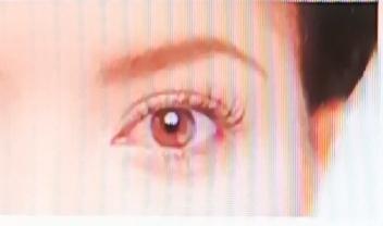 玻璃体混浊和飞虫现象（飞蚊症）可不一样。飞蚊症是症状，玻璃体混浊是体征。从病因