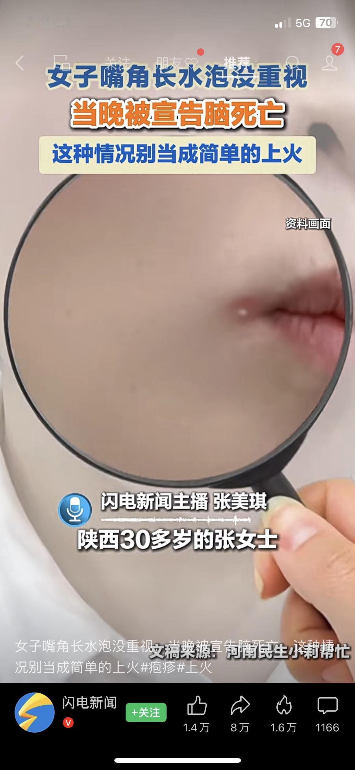 真的被这个案例吓到了！😨千万别再把嘴角长水泡当成普通“上火”了！据闪电新