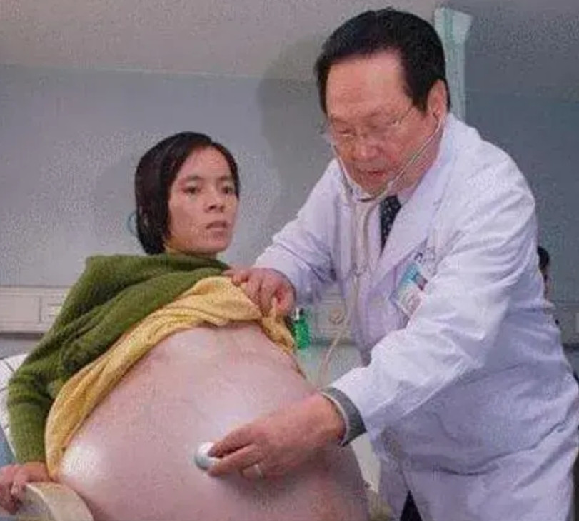 广东女子怀孕12个月，却迟迟未生，婆婆高兴地合不拢嘴：“肚子这么大，至少是双胞胎