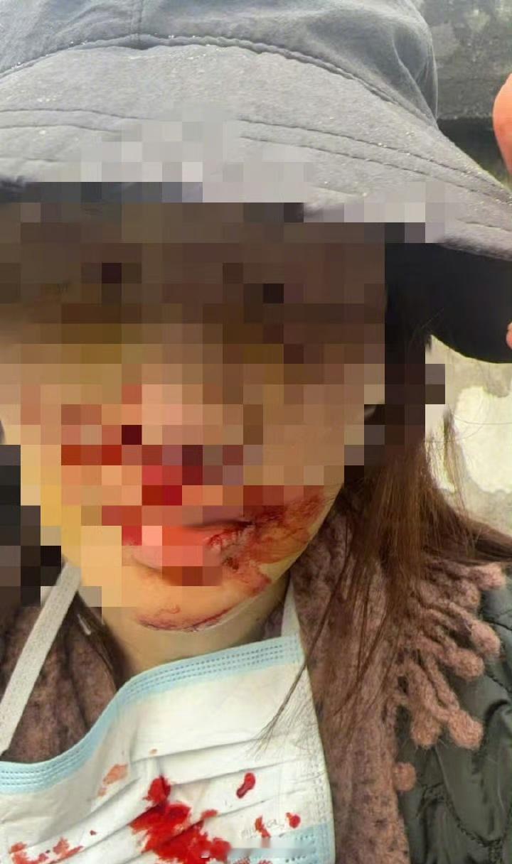 曝金晨经常半夜练车金晨经常晚上练车：“金晨，我今天一看见这个热搜，确实有点可惜，