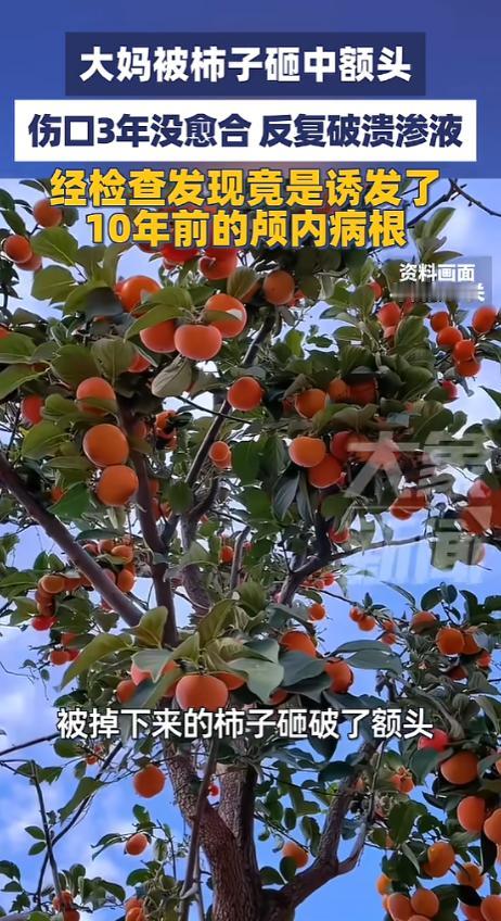 “万万没想到！”6月5日报道，江苏南京，一大妈被掉下来的柿子砸破头，她看这上过剖