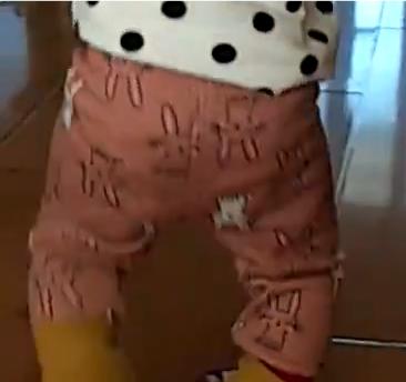 外孙女说，姥姥，我腿是怎么了？昨天躺床上呆着没事，翻看我外孙女以前的视频，有一