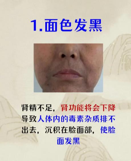 男士精气耗损的几大表现，看看你中了几条？