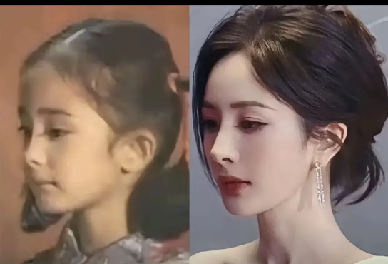 杨幂的下巴一直就是这样啊，真没什么好大惊小怪的，从她小时候到现在都没什么变化。