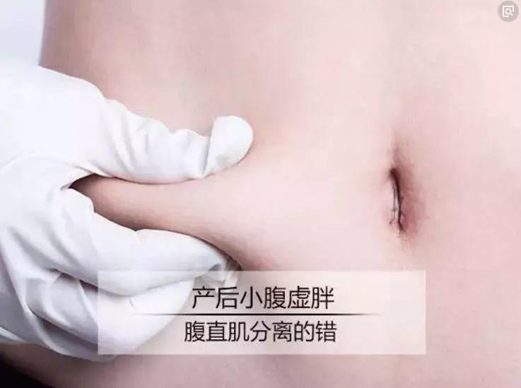 为什么生完孩子就瘦不下来? 其实TA才是元凶