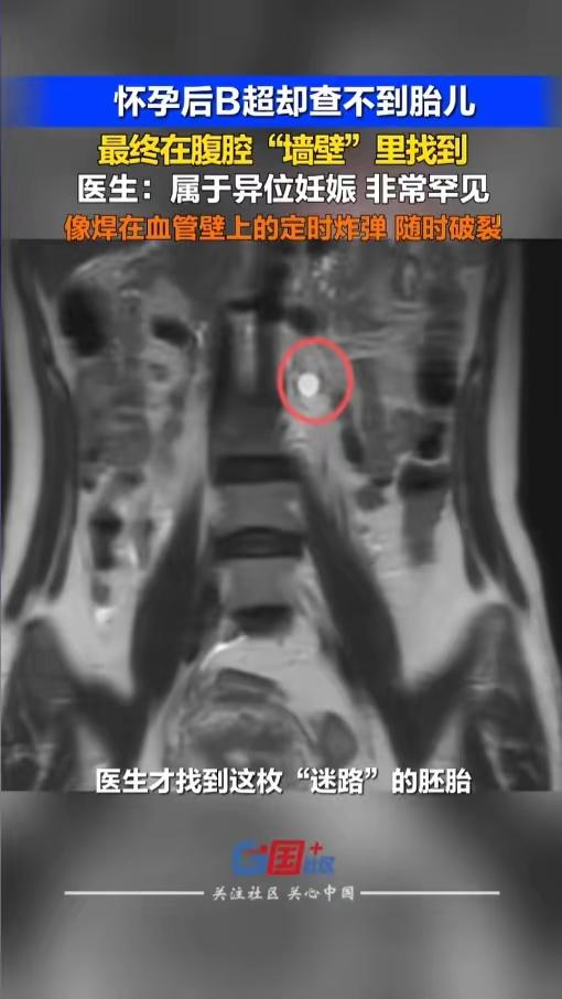 5月7日，深圳一名女子验孕棒显怀孕，医院检查却爆出惊魂一幕。 抽血确认妊娠无