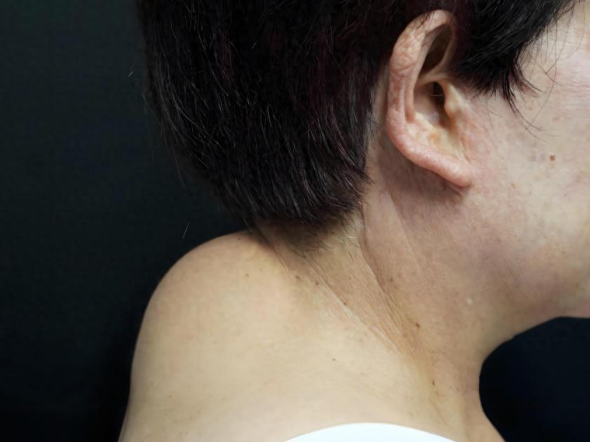 富贵包不富贵，是健康大麻烦！4个穴位坚持按，帮你平推富贵包内容仅供参考，如有