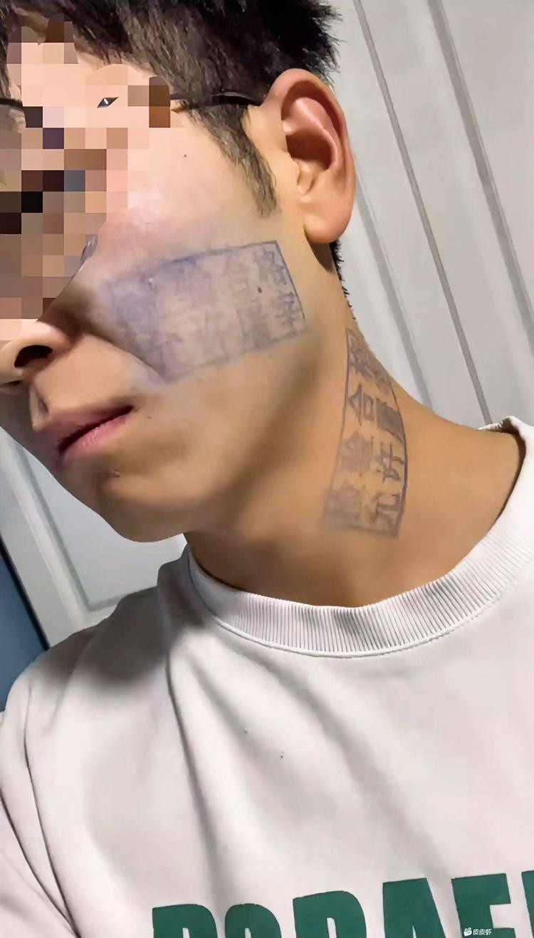 朋友们，问你们个事！被人别车还打了一架，脸上留了两个印子洗不掉，在线求支招怎么去