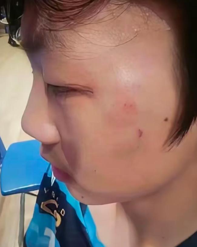 11:0被零封后，他挥拳砸向对手伸出的手！这一拳，打飞的不只是球拍 江苏青少