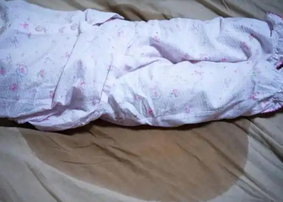 还是老百姓懂中医呀1：嘴角上火，张嘴就很痛，以前人说这是脾火，用锅盖上面的水