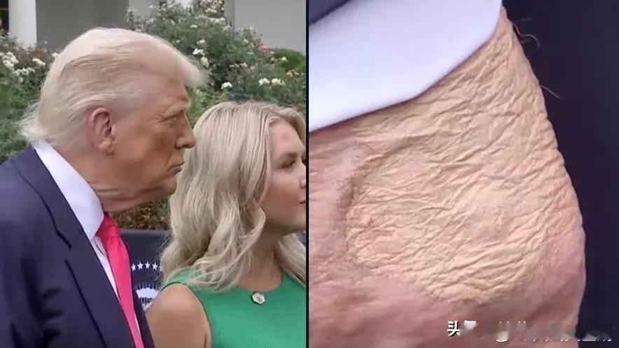 哦豁！特朗普，手部特写照正在外网疯传……​​​这应该是他的手，不是p图，