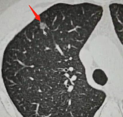 昨天接诊了个23岁的小伙子，一进诊室眼眶就通红，坐下没两句话就带着哭腔问我：“乔