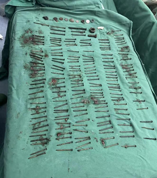 解释不清了！8月9日媒体发布，云南一男子腹痛9天，吃啥吐啥，眼看命悬一线，医院一
