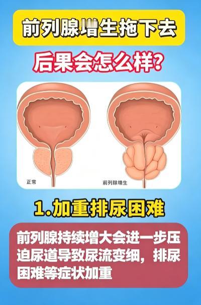 前列腺增生久拖不治，4个不良后果要警惕