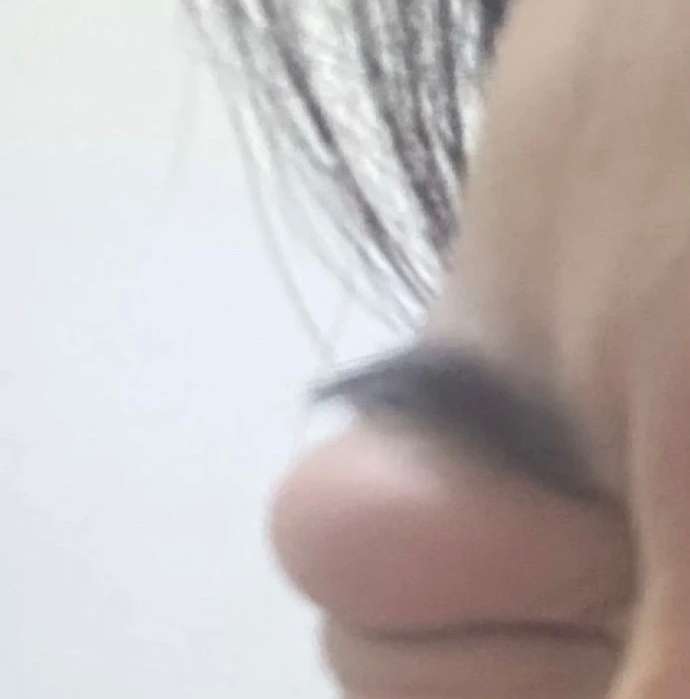 女朋友半夜哭着给我打电话，说被蚊子咬了，我说不至于吧，她发了个照片我绷不住了。