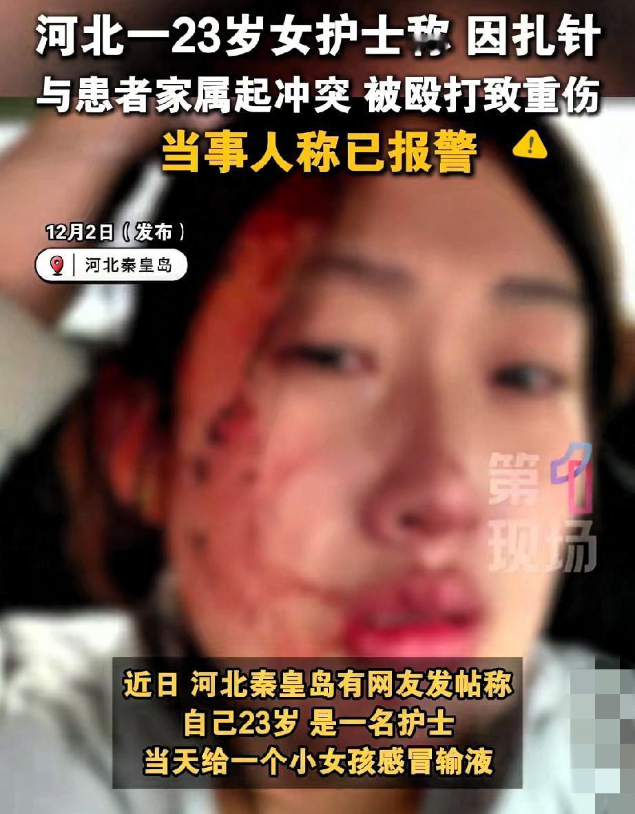 两拳砸向护士的瞬间，疼的不只是一张脸真的越看越气！秦皇岛那位23岁护士的