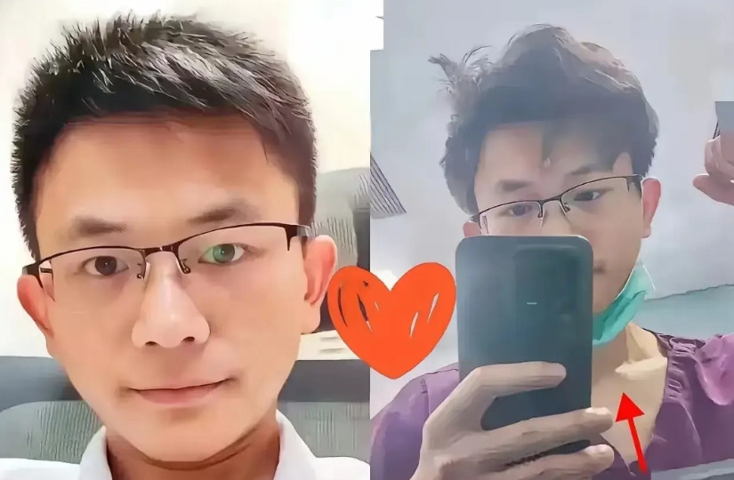 罗帅宇医生还是太年轻了，他在举报违法犯罪事件中，忘记保护自身安全了。湘雅附二