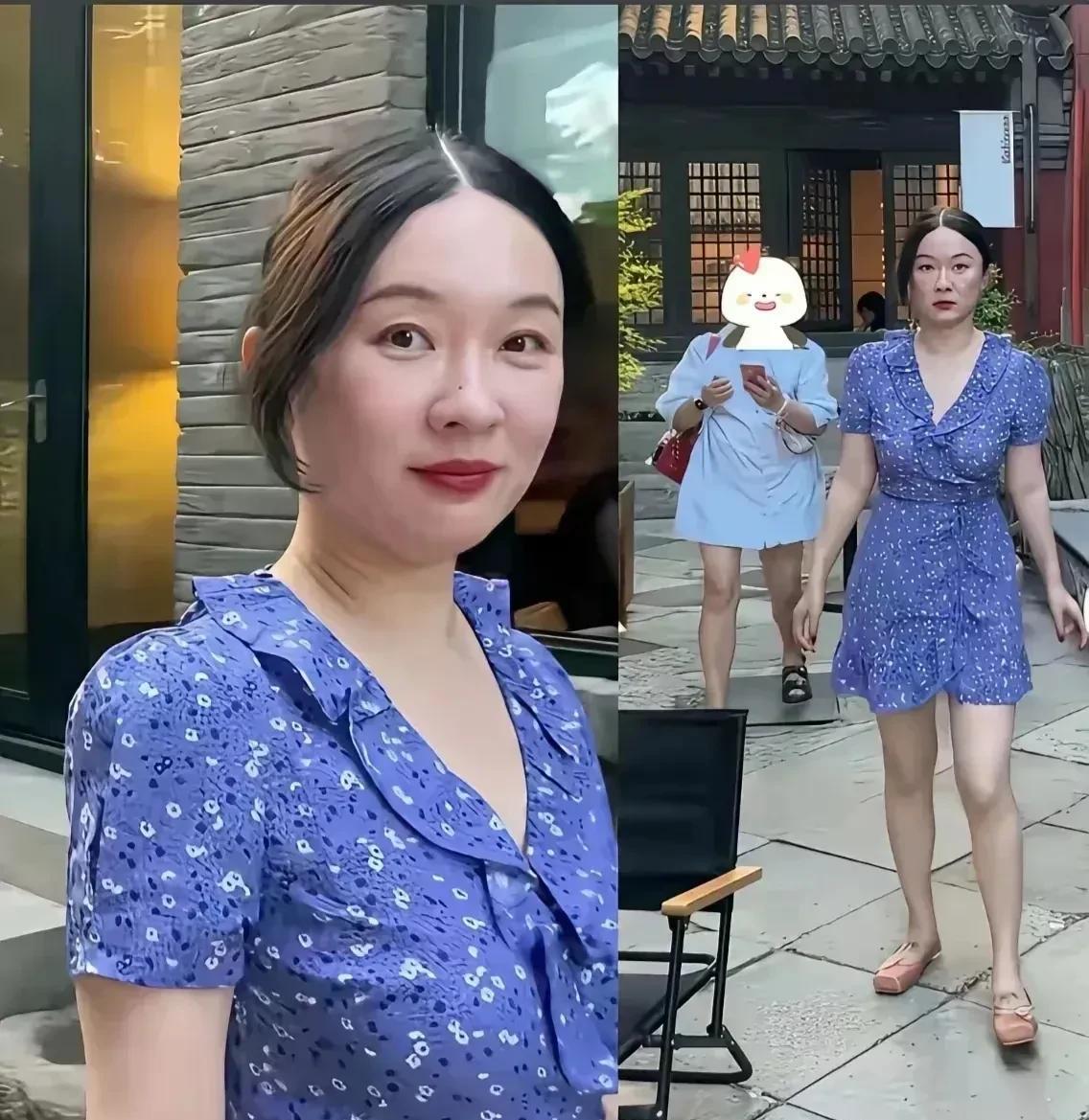 霍思燕演戏演的好好的，息影了；年纪轻轻风华正茂，植发了。不过看到霍思燕煞白