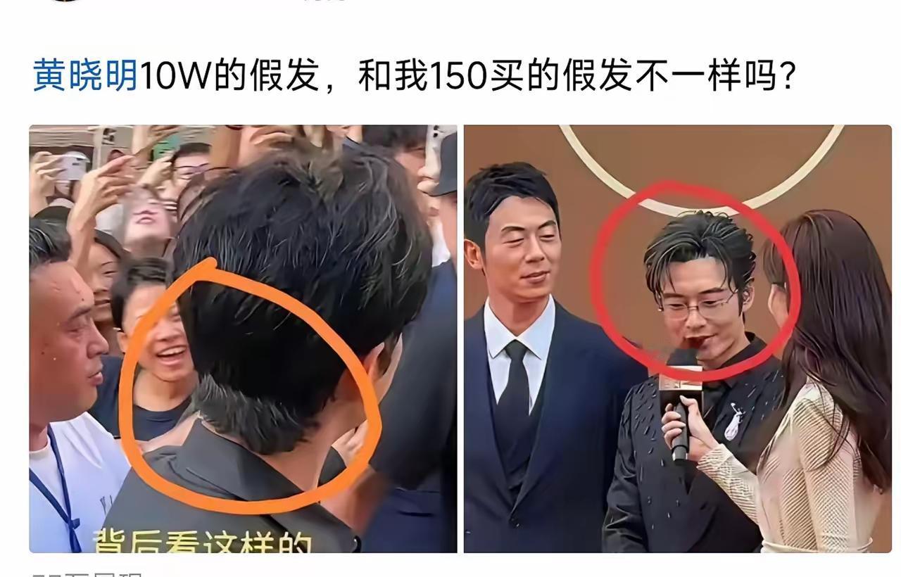黄晓明年轻的时候头发就不多，他应该很早就戴假发了。这也没什么，工作需要嘛。