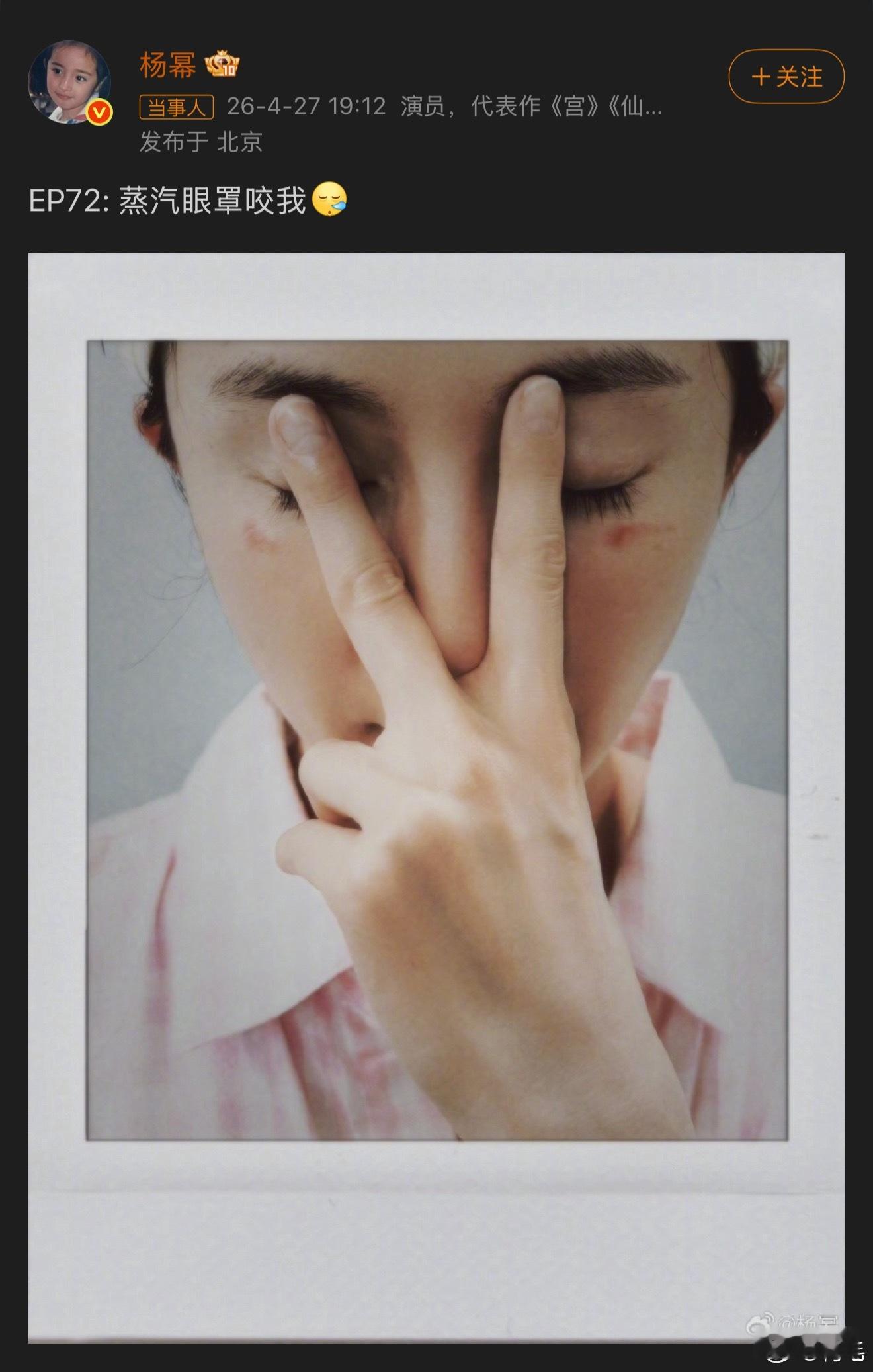 杨幂脸被蒸汽眼罩烫伤了刚看到杨幂脸被蒸汽眼罩烫伤的消息，惊了一下，一直觉得那东西