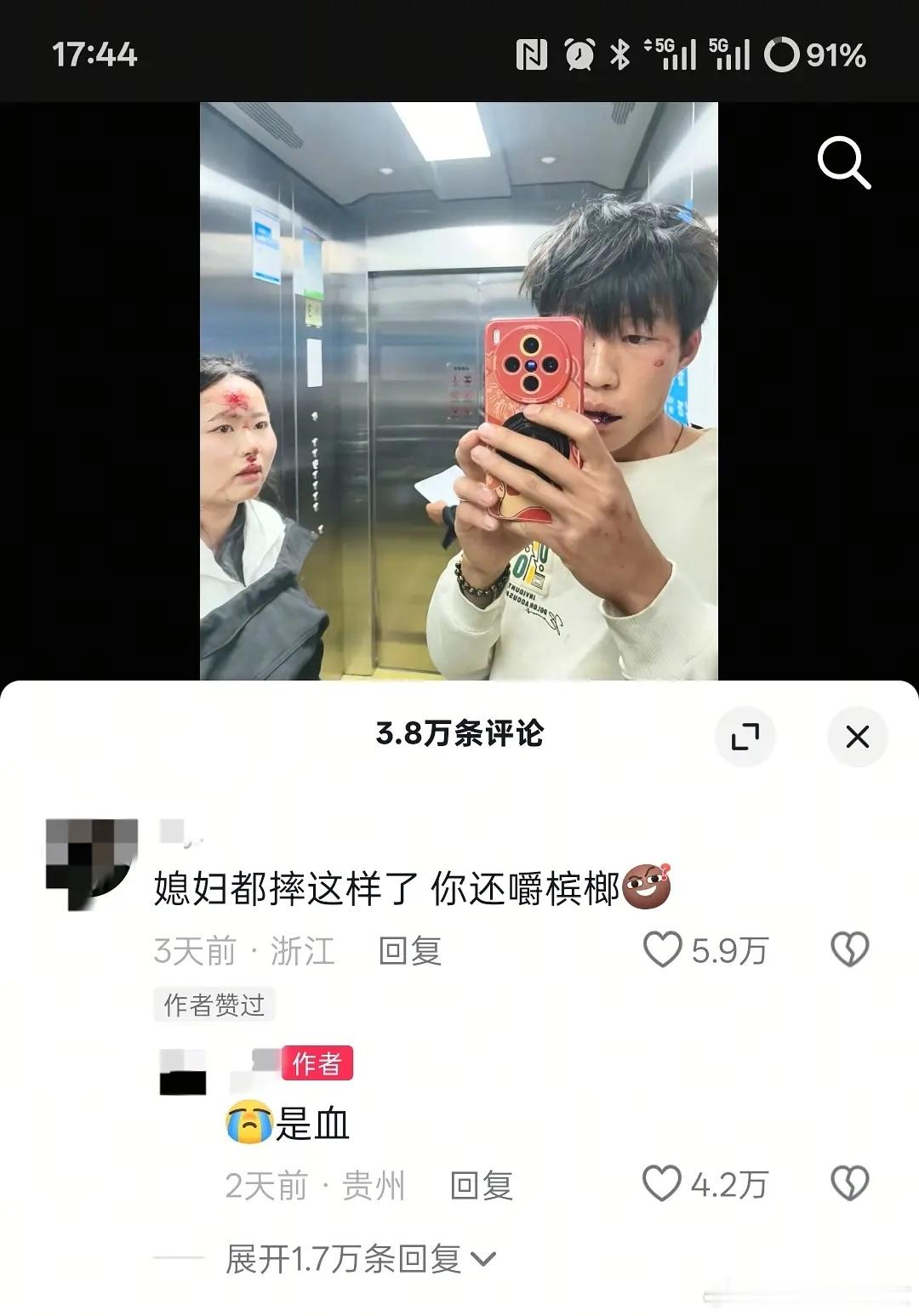 神特么“媳妇都摔成这样了，你还在嚼槟榔”​​​
