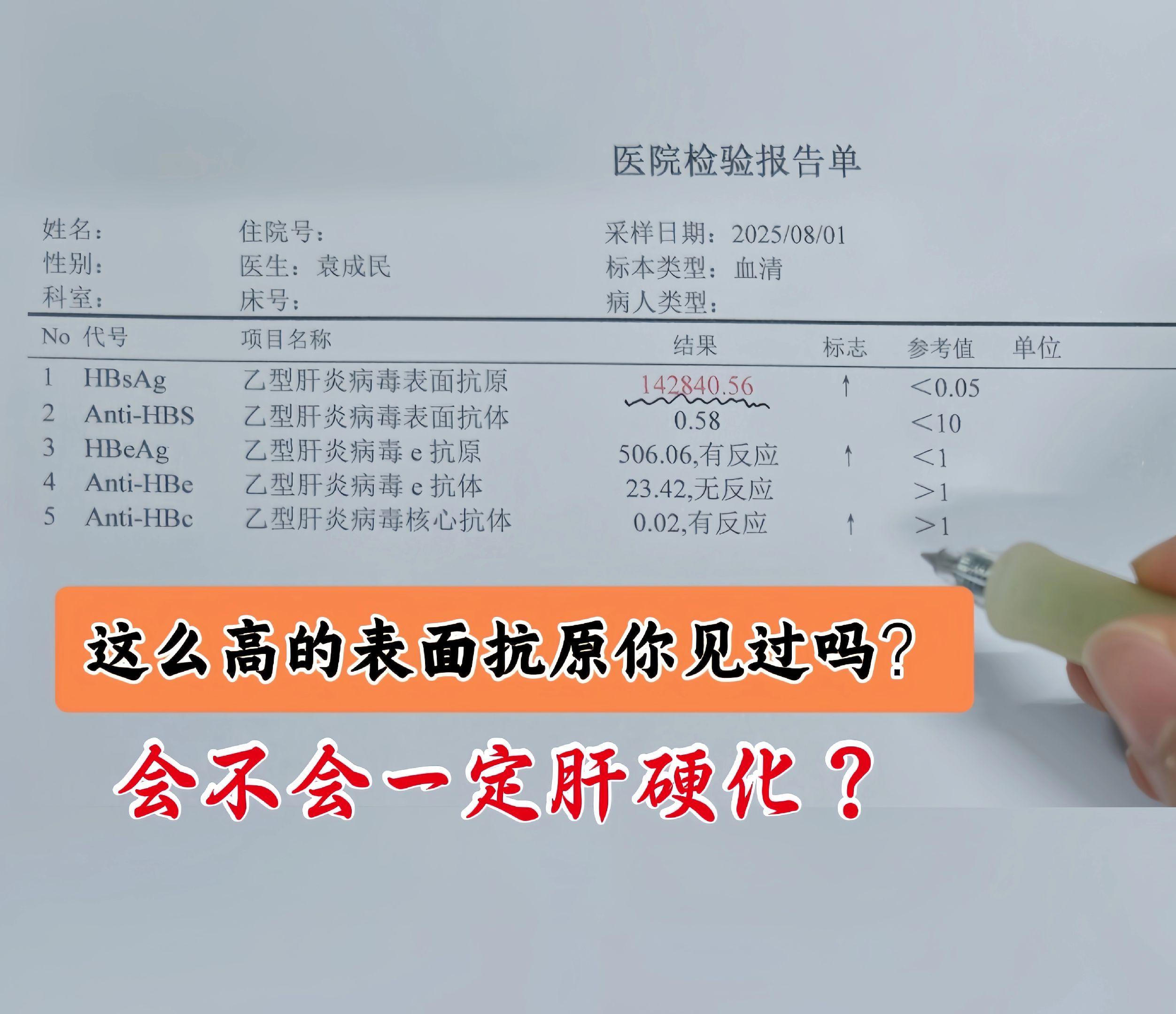 前几天门诊上32岁的泰安小伙体检发现表面抗原竟然高达14万，患者非常的...