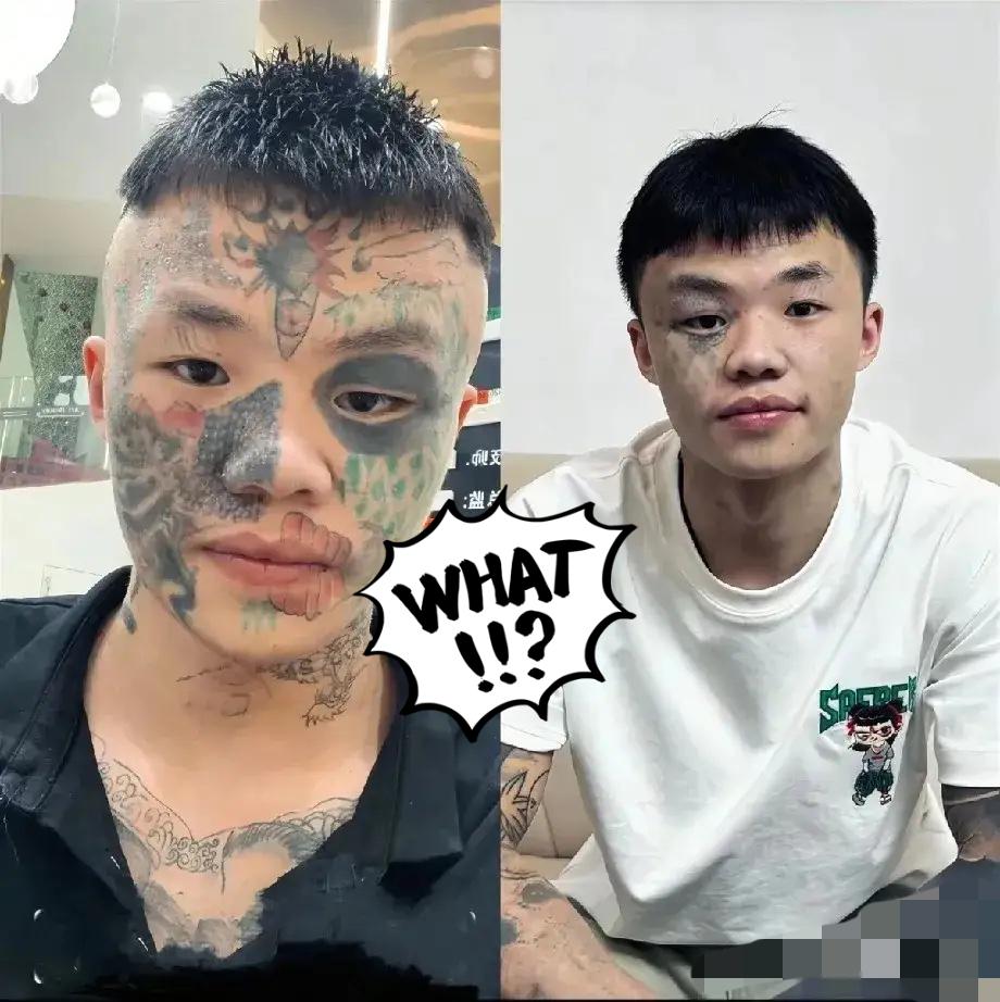 “后悔了吧？”“疼到咬碎牙也得洗！”06年的广东男孩夏朝勇，正扛着第五次