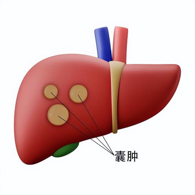 医院不愿公开的3个散结中药方, 有效又便宜, 人人都用得起