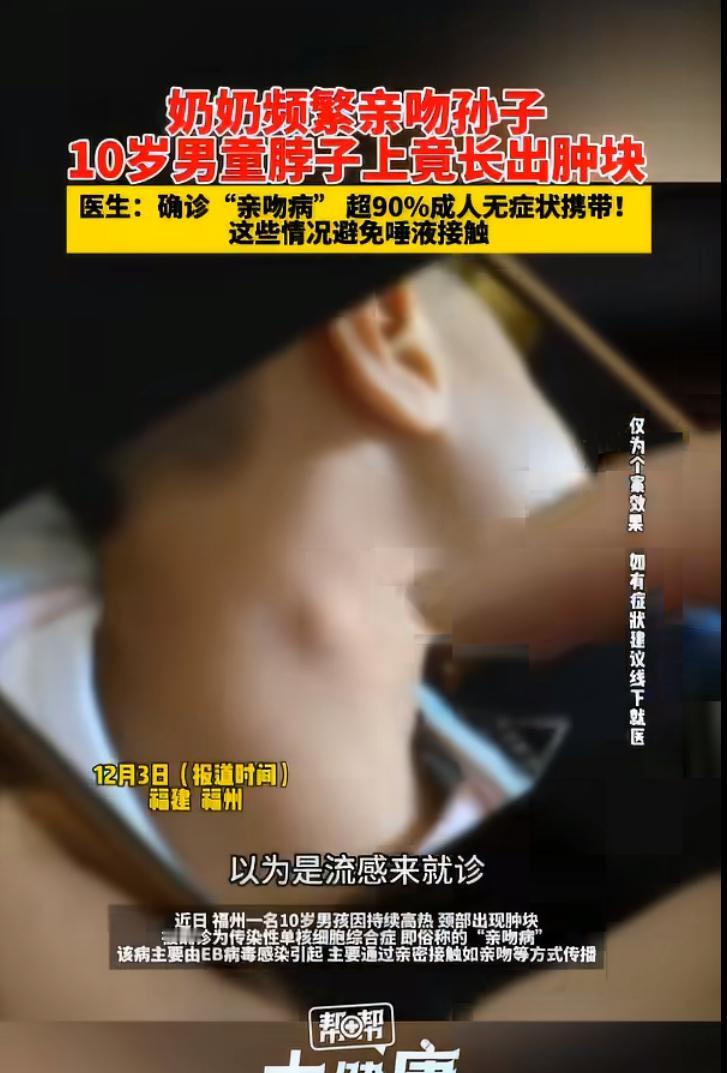 江苏淮安一名8岁男孩持续高烧不退，脖子上还肿起鸽子蛋大小的肿块。就医后确诊为传染