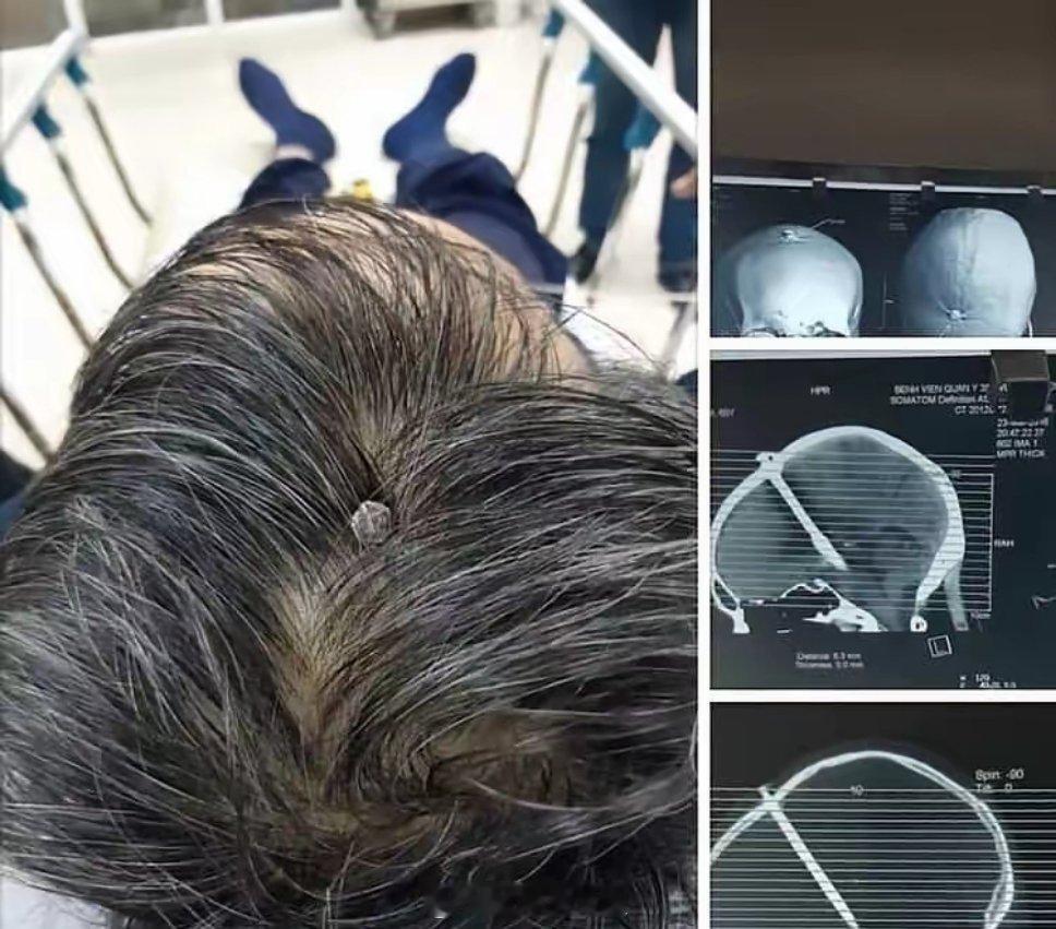 只是让天理给降罪了？？​​​