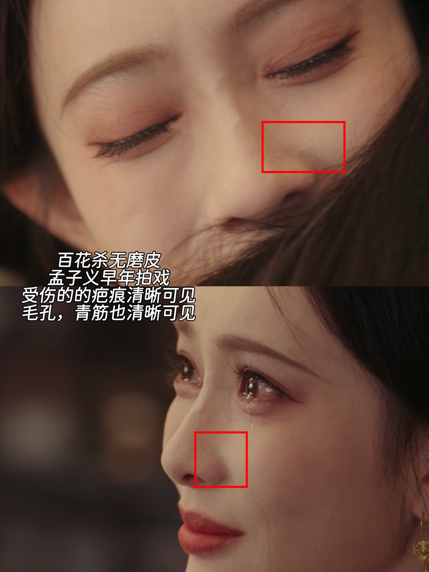 其实打开高清4k，百花杀根本就没有磨皮，孟子义的青筋，毛孔，疤痕都能一一看见孟子